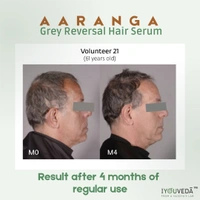3 Month Pack Aaranga Grey Reversal Hair Serum  - White, 120 ml
