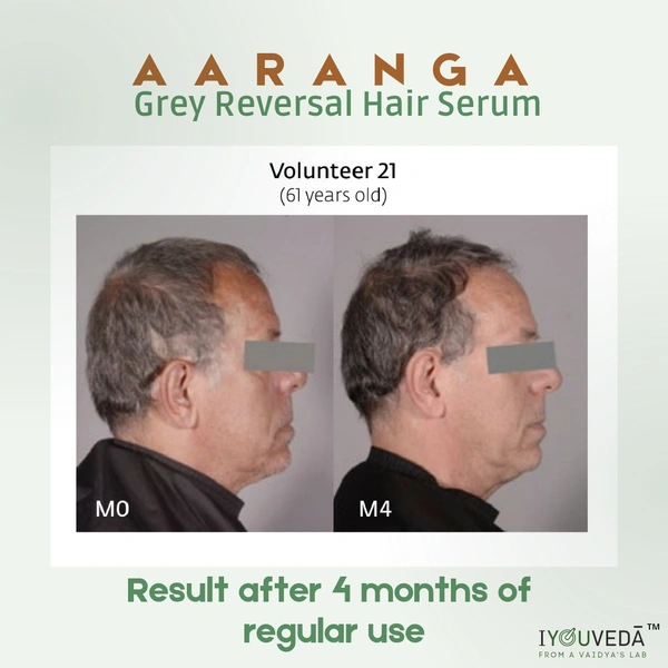 3 Month Pack Aaranga Grey Reversal Hair Serum  - White, 120 ml