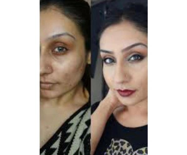 HR COSMETIC Kanchan Kaya Face fairness cream 15gm for blemish control and acne spots. - FACE CREAM, CREAM