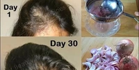 Red Onion Black Seed Oil & Shampoo Ultimate Hair Care Kit (Shampoo + Hair Oil) (2 Items in the set)