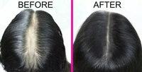 Red Onion Black Seed Oil & Shampoo Ultimate Hair Care Kit (Shampoo + Hair Oil) (2 Items in the set)