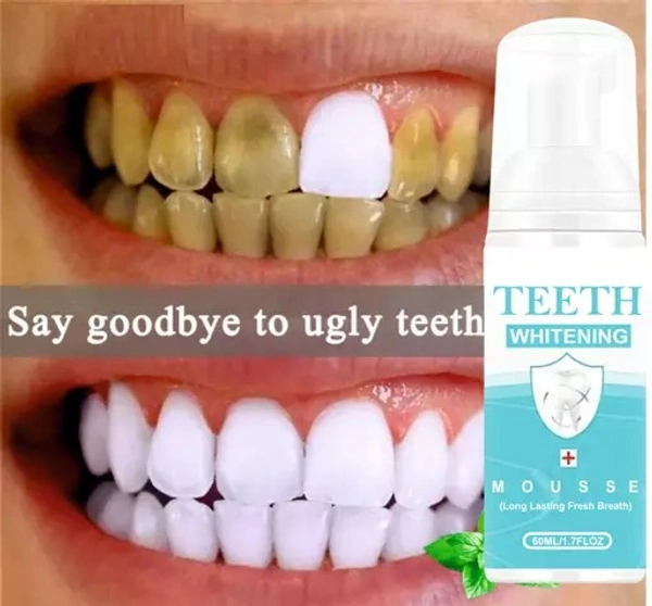 Teeth Whitening Foam To Removes Bad Breath Fights Germs For Men & Women- Teeth Whitening Foam Best (60 ml) Pack of 1 - 