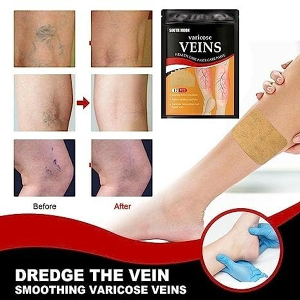 Veins Patches Dredge Vein Smoothing Varicose Veins Reduce Swelling Relieve Pain Instant Relief From Muscular Pain Improve Blood Circulation Skin Friendly (12pcs)