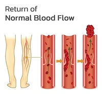 Veins Patches Dredge Vein Smoothing Varicose Veins Reduce Swelling Relieve Pain Instant Relief From Muscular Pain Improve Blood Circulation Skin Friendly (12pcs)