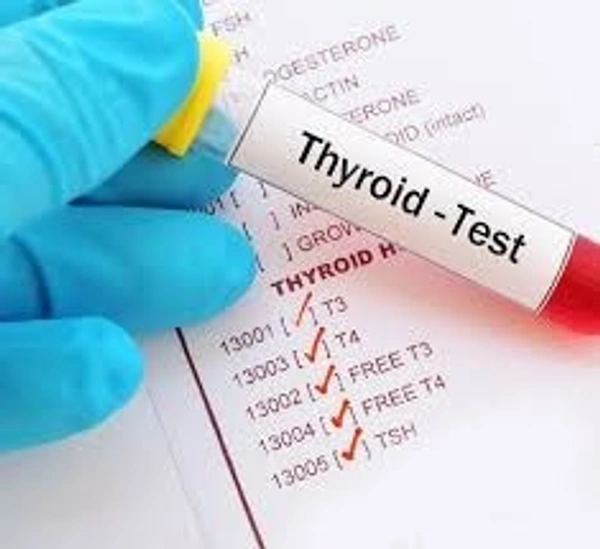 Thyroid Test