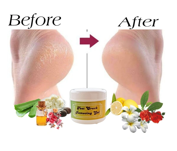 1 bottle NILA FOOT CRACK REMOVEING GEL  50 grm - 70grm, Mint Green, 100 % natural
