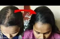 Natural Adivasi Hair Oil 300ml(pack of 3)