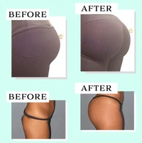Butt - Lift Shaping Patch Set 