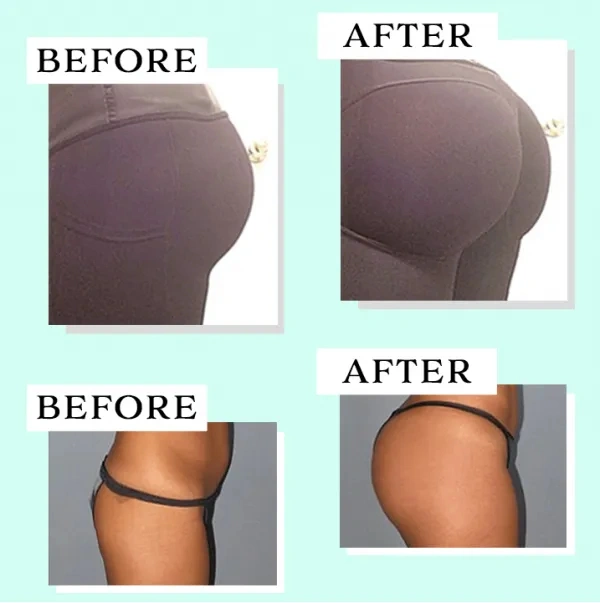 Butt - Lift Shaping Patch Set 