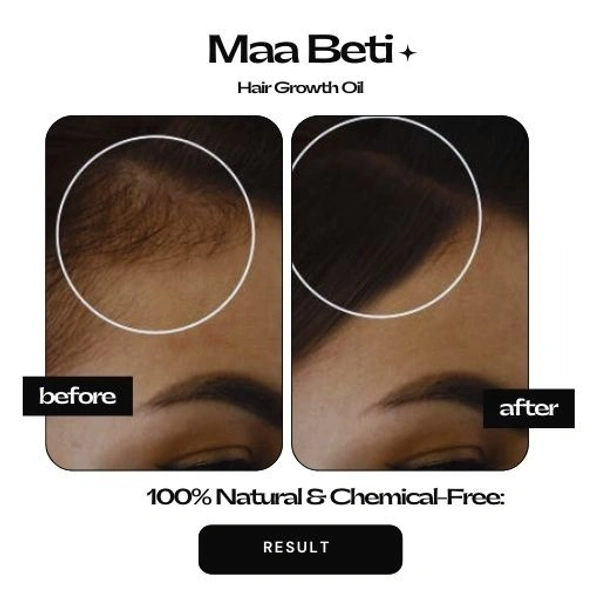 Maa Beti Hair Oil Maa Beti Hair Growth Oil - Homemade Amla, Bhringraj, Brahmi Blend for Strong, Long, Thick Hair - 200ml