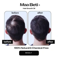 Maa Beti Hair Oil Maa Beti Hair Growth Oil - Homemade Amla, Bhringraj, Brahmi Blend for Strong, Long, Thick Hair - 200ml