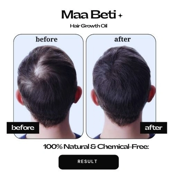 Maa Beti Hair Oil Maa Beti Hair Growth Oil - Homemade Amla, Bhringraj, Brahmi Blend for Strong, Long, Thick Hair - 200ml
