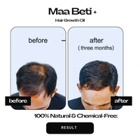 Maa Beti Hair Oil Maa Beti Hair Growth Oil - Homemade Amla, Bhringraj, Brahmi Blend for Strong, Long, Thick Hair - 200ml