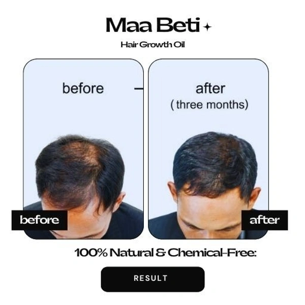 Maa Beti Hair Oil Maa Beti Hair Growth Oil - Homemade Amla, Bhringraj, Brahmi Blend for Strong, Long, Thick Hair - 200ml
