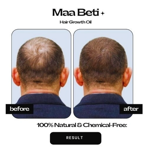 Maa Beti Hair Oil Maa Beti Hair Growth Oil - Homemade Amla, Bhringraj, Brahmi Blend for Strong, Long, Thick Hair - 200ml