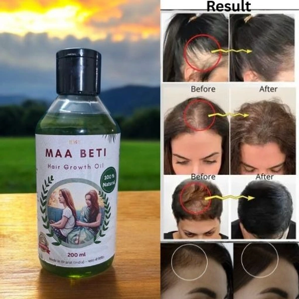 Maa Beti Hair Oil Maa Beti Hair Growth Oil - Homemade Amla, Bhringraj, Brahmi Blend for Strong, Long, Thick Hair - 200ml