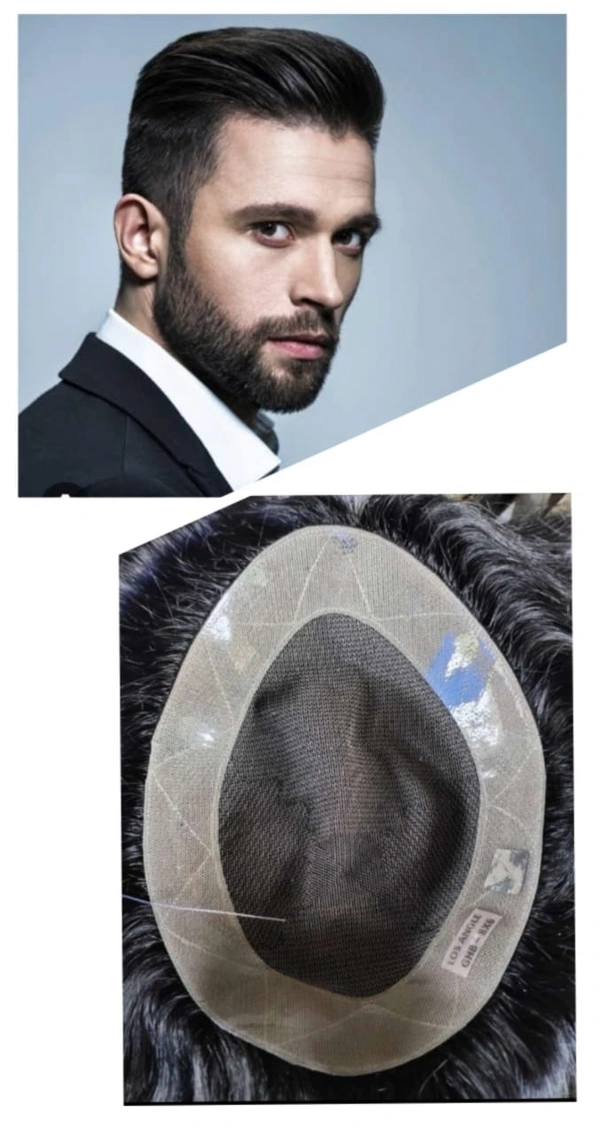 Loss Angles Hair Wigs 