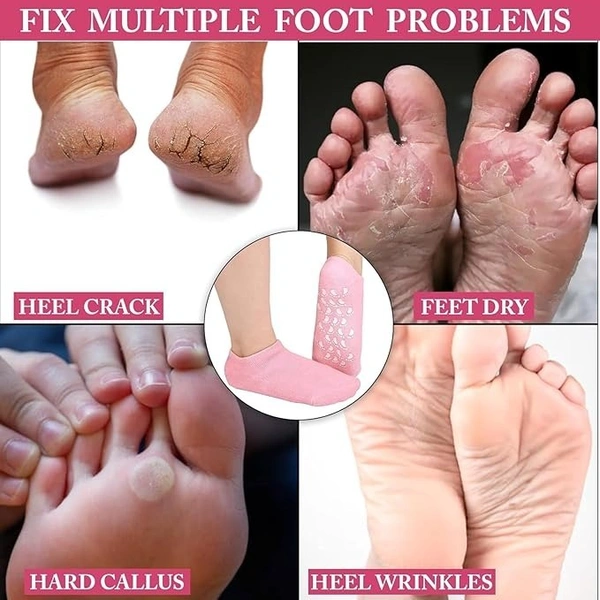 Silicon Spa Gel Socks (1Pair)