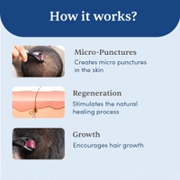Derma Roller  How to Use a Derma Roller at Home in 60 Seconds” - Black