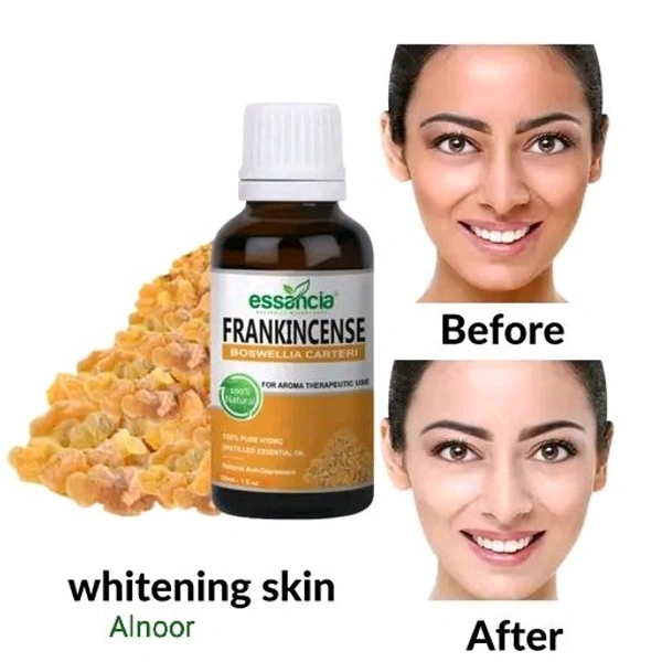 ESSENTIAL FRANKINCENSE OIL