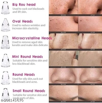 Classic Acne PCENF5334  Treatment Devices*Capacity: 150gIdeal For: UnisexNet Quantity (N): 1Dispatch: 2 Days*Proof of Safe Delivery! Click to know on Safety Standards of Delivery Partners- https://ltl.sh/y_nZrAV3