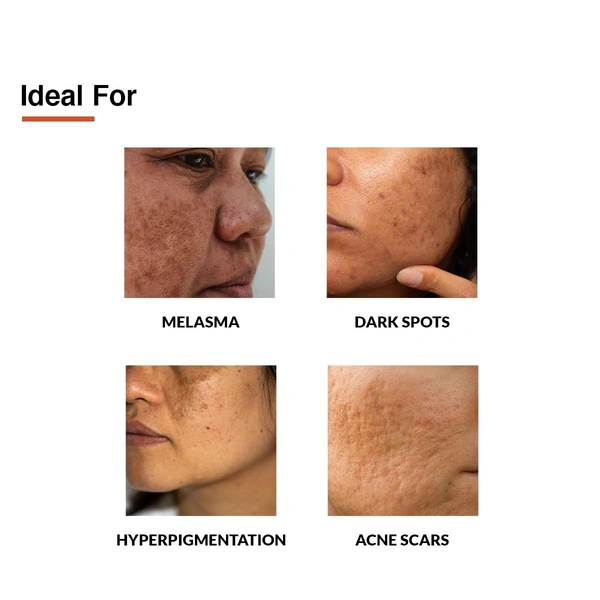 Fixderma 10% Tranexamic Acid + 2% Kojic Acid + 1% Arbutin SKARFIX -TX Face Cream | Pigmentation Removal Cream | Uneven Skin Tone, Reduces Dark Spots and Blemishes - 15g