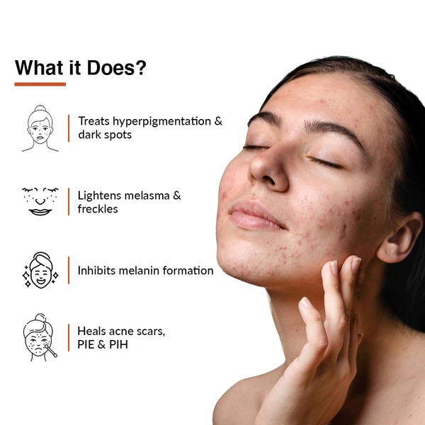 Fixderma 10% Tranexamic Acid + 2% Kojic Acid + 1% Arbutin SKARFIX -TX Face Cream | Pigmentation Removal Cream | Uneven Skin Tone, Reduces Dark Spots and Blemishes - 15g