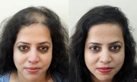 Adivasi Hair Oil & Shampoo – Herbal Solution for Hairfall & Hair Growth - 