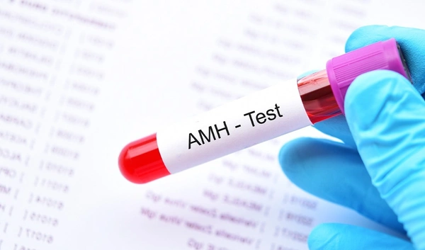 Anti-Mullerian Hormone (AMH) Test
