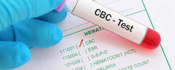 CBC (Complete Blood Count)
