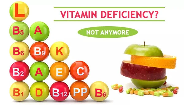 Complete Vitamins Profile 