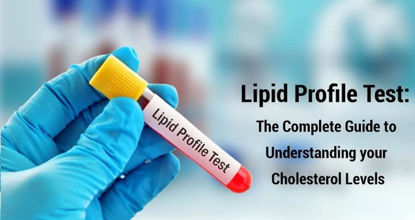 Lipid Profile Test 