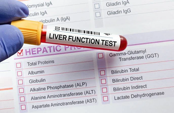 Liver Function Test 