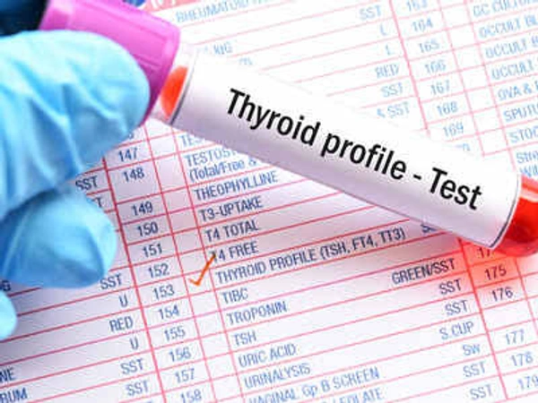 Thyroid Profile Basic