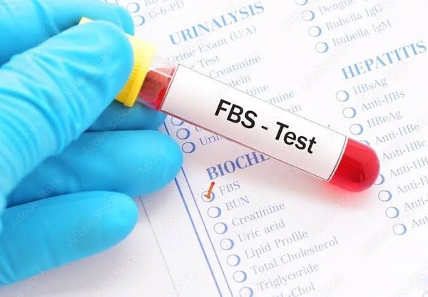 Fasting Blood Sugar (FBS)
