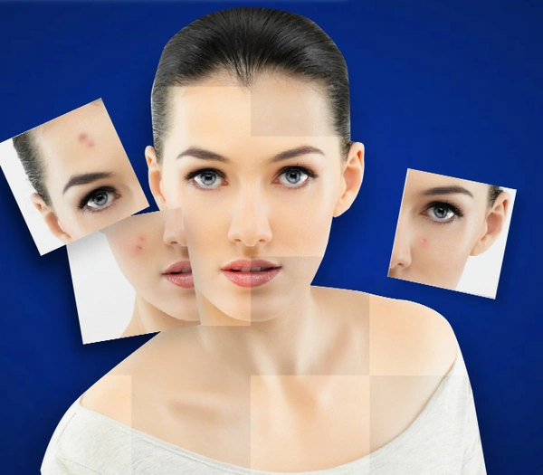 WOMENS SKIN CARE CHECKUP