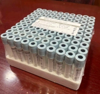 GPR Blood Collection Fluoride Tube  - 2Ml, Gray