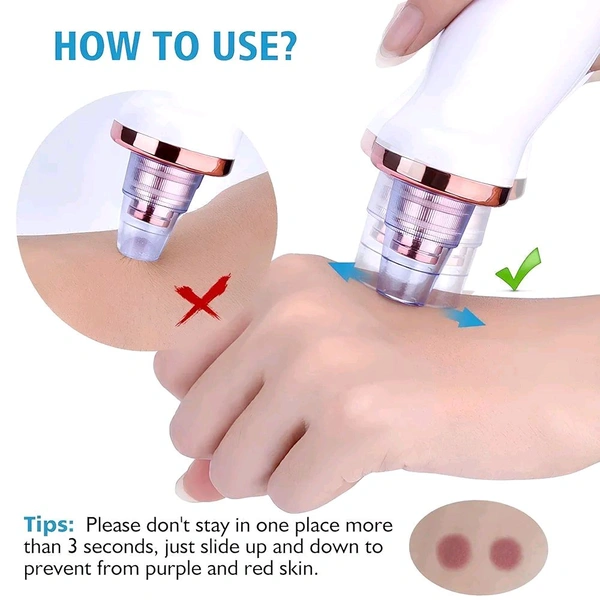 Multi-Functional Blackhead Remover – Electric Pore Vacuum Cleaner
