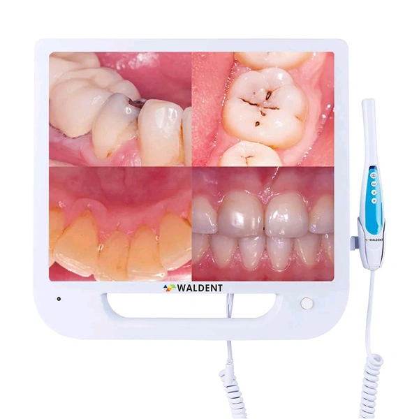 Walldent Waldent Intra Oral Camera with Screen - Ergo (10 MP)