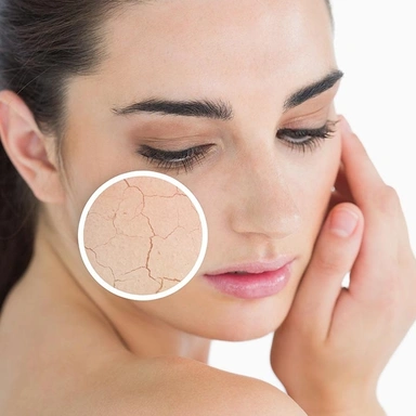Dry Skin