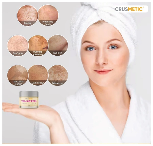 Crusmetic Yellow Peel Reduce Dark Spots | Pigmentation|Improve Skin Colour | Wrinkles and helps in anti-ageing.