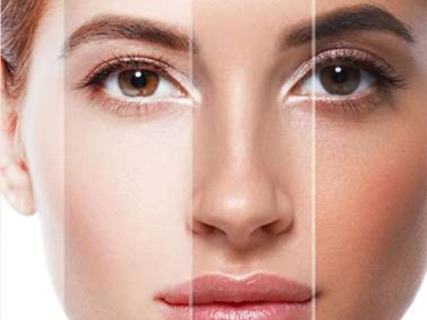WHITENING PEEL