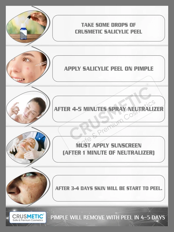 Crusmetic Salicylic Peel 30% - Advanced Acne Treatment Formula