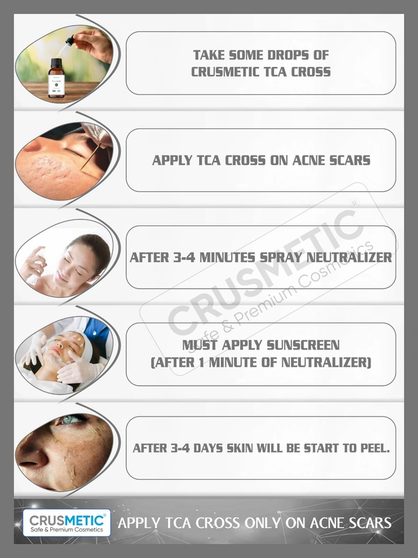 A TCA Cross 80% -  Acne Scars Solution