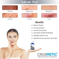 Crusmetic Salicylic Peel 30% - Advanced Acne Treatment Formula