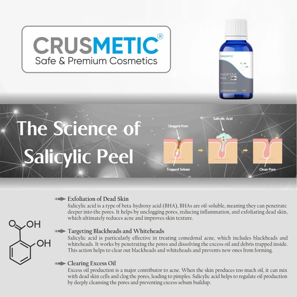 Crusmetic Salicylic Peel 30% - Advanced Acne Treatment Formula