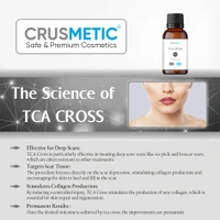 A TCA Cross 80% -  Acne Scars Solution