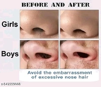 Face Epillators