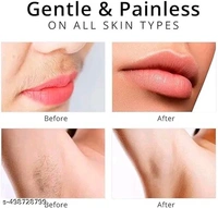 Face Epillators