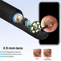 Portronics Xlife Smart Wireless Ear Otoscope Cleaner with 6 LED Lights